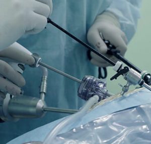 Dr Hugh Wolfenden Minimal Access and Robotic Surgery Keyhole Surgery Surgeries Image
